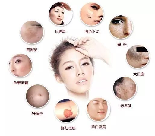 美白淡斑要怎么做才有效果?